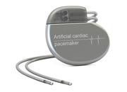 ペースメーカーのイメージ画像
